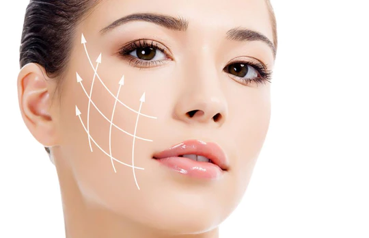 calabloom Threadlifting