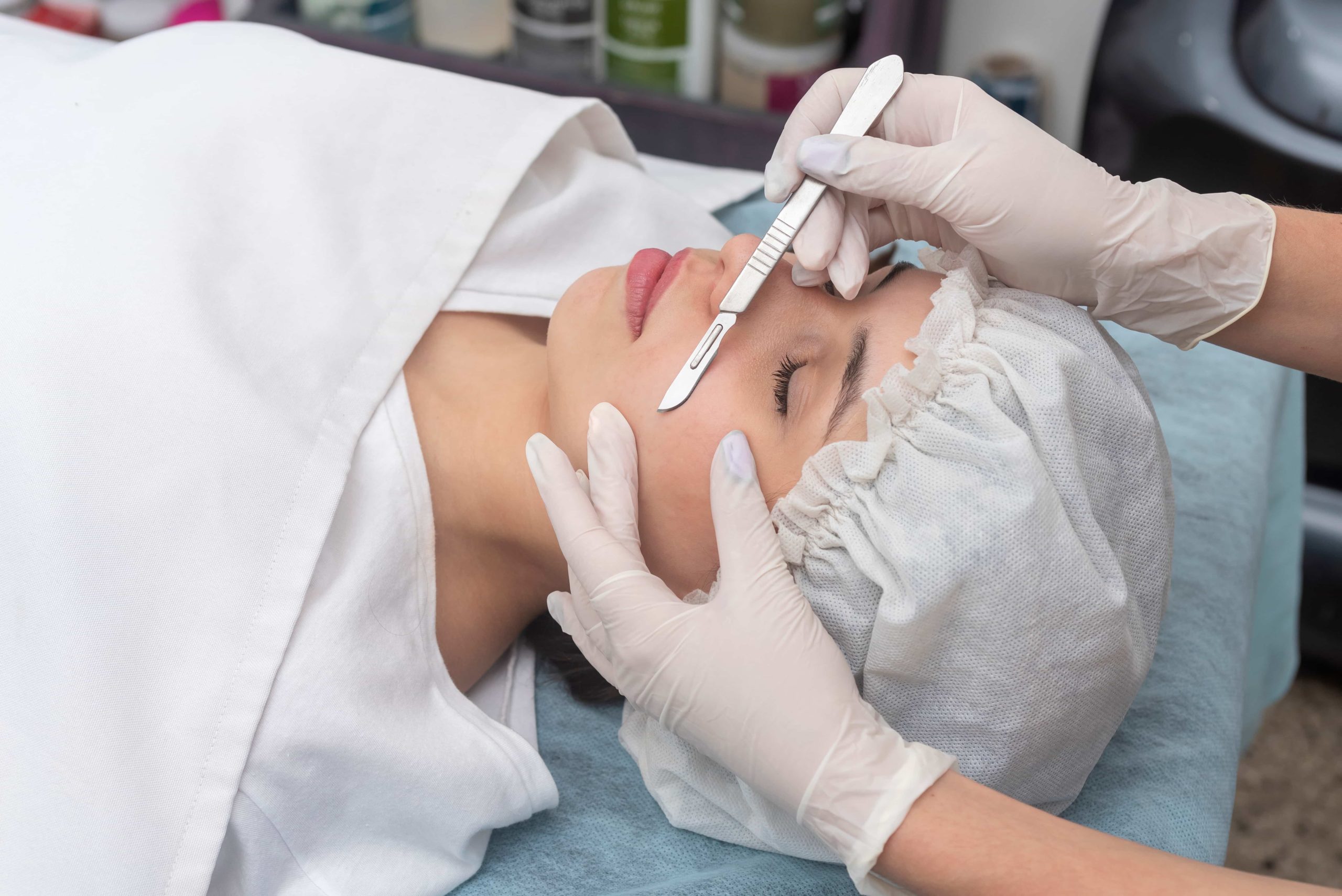Dermaplaning Calabloom Medspa in CA