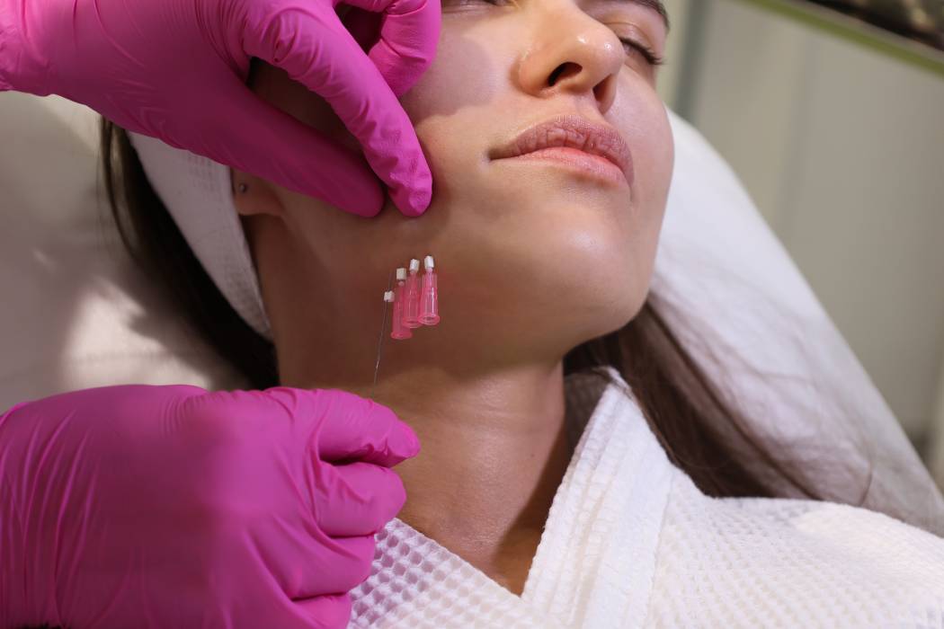 Blog 4 PDO Threads _ Calabloom Medspa _ Torrance, CA